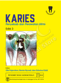 Karies: Penyebab dan Perawatan Klinis Ed. 3