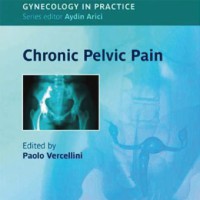 Chronic Pelvic Pain