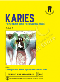 Image of Karies: Penyebab dan Perawatan Klinis Ed. 3